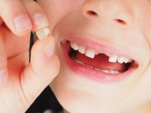 Çocuğunuzun diş hekimi fobisi mi var?